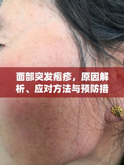 面部突发疱疹，原因解析、应对方法与预防措施